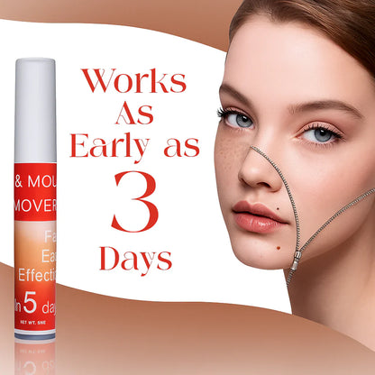 LOVILDS™ Tags & Moles Remover (Buy 1 Get 1 Free)