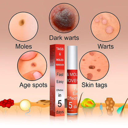 LOVILDS™ Tags & Moles Remover (Buy 1 Get 1 Free)